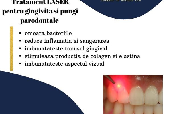 TRATAMENTE LASER PARODONTOZA