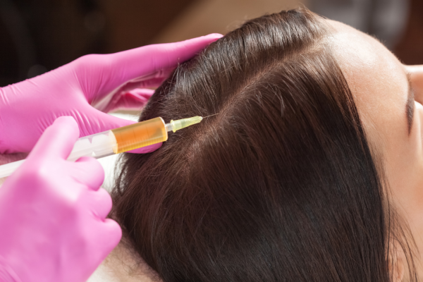 TERAPIA VAMPIR PRP