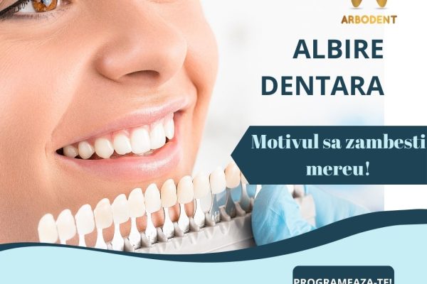 Albire dentara cu laser Oradae